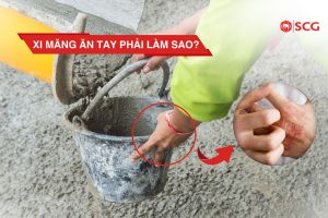 xi mang an tay phai lam sao 3 f3c85596 https://truyen.linhdev.online/tu-van/ xi măng ăn tay phải làm sao
