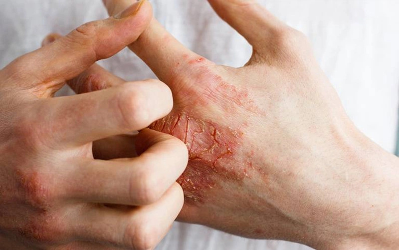 xi măng ăn tay phải làm sao xi măng ăn tay phải làm sao